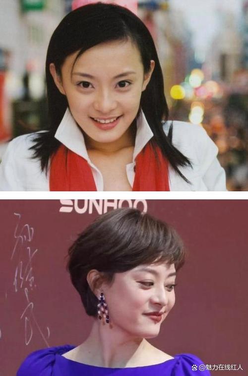 2025澳门天天开好彩免费和孙俪唇下痣没了与孙俪嘴唇的痣